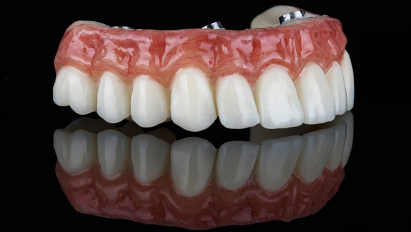 Ways You Can Keep Your Implant Supported Dentures Clean And Functional