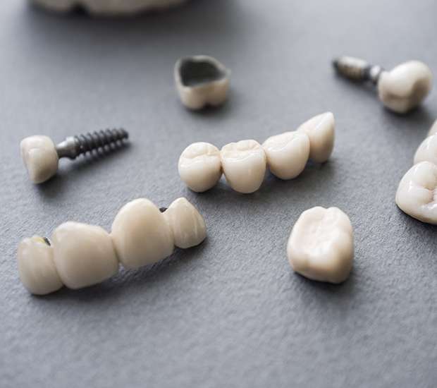 Omaha The Difference Between Dental Implants and Mini Dental Implants
